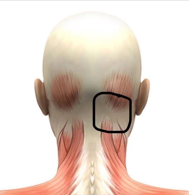 Anatomical illustration showing the suboccipital muscle region at the base of the skull